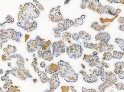 FAK Recombinant Rabbit mAb - BF4047 at 1/100 staining Human placental tissue by IHC-P.