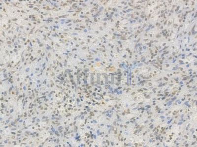 Histone H3 Recombinant Rabbit mAb - BF4048 at 1/100 staining Human spleen tissue by IHC-P.
