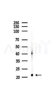 Histone H3 Recombinant Rabbit mAb - Western blot analysis of lysates from Mouse kidney, using Histone H3 Recombinant Rabbit mAb at 1/1000 dilution.