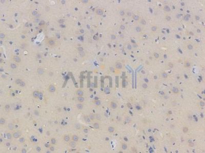 beta III Tubulin Recombinant Rabbit mAb - BF4050 at 1/100 staining Rat brain tissue by IHC-P.