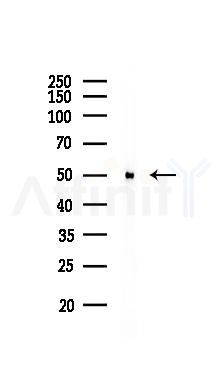 beta III Tubulin Recombinant Rabbit mAb - Western blot analysis of lysates from B16F10-LUC cells(heat-shock 45min treatment), using beta III Tubulin Recombinant Rabbit mAb at 1/1000 dilution.