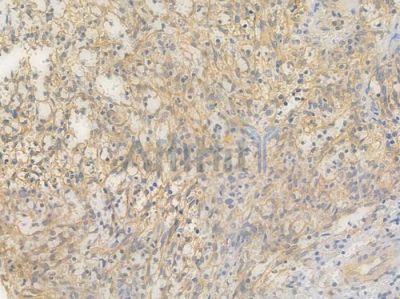 FADS1 Recombinant Rabbit mAb - BF4052 at 1/100 staining Human spleen tissue by IHC-P.