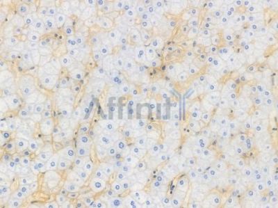 CD81 Recombinant Rabbit mAb - BF4053 at 1/100 staining Human liver tissue by IHC-P.