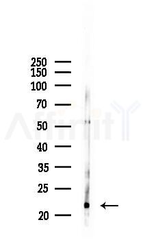 CD81 Recombinant Rabbit mAb - Western blot analysis of lysates from Hela cells(LPS 4h treatment), using CD81 Recombinant Rabbit mAb at 1/1000 dilution.