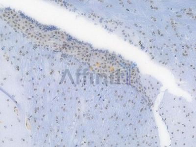 TriMethyl-Histone H3 (Lys27) Recombinant Rabbit mAb - BF4054 at 1/100 staining Mouse brain tissue by IHC-P.