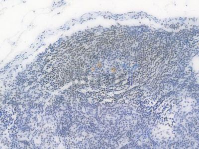 TriMethyl-Histone H3 (Lys27) Recombinant Rabbit mAb - BF4054 at 1/100 staining Human lymph node tissue by IHC-P.