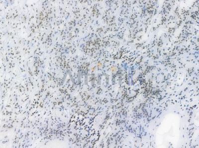 TriMethyl-Histone H3 (Lys27) Recombinant Rabbit mAb - BF4054 at 1/100 staining Human tonsil tissue by IHC-P.