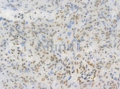 TriMethyl-Histone H3 (Lys27) Recombinant Rabbit mAb - BF4054 at 1/100 staining Human spleen tissue by IHC-P.