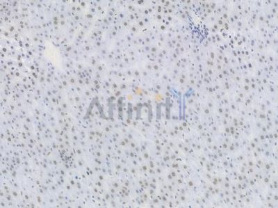 TriMethyl-Histone H3 (Lys27) Recombinant Rabbit mAb - BF4054 at 1/100 staining Rat liver tissue by IHC-P.