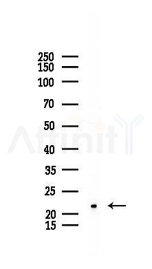 TriMethyl-Histone H3 (Lys27) Recombinant Rabbit mAb - Western blot analysis of lysates from Mouse lung, using TriMethyl-Histone H3 (Lys27) Recombinant Rabbit mAb at 1/1000 dilution.