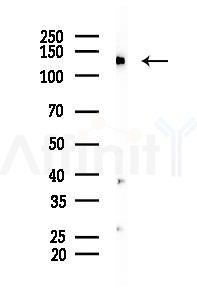 p130 Cas Recombinant Rabbit mAb - Western blot analysis of lysates from Rat brain, using p130 Cas Recombinant Rabbit mAb at 1/1000 dilution.
