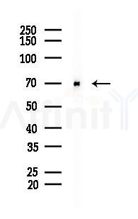 YTHDF1 Recombinant Rabbit mAb - Western blot analysis of lysates from Rat brain, using YTHDF1 Recombinant Rabbit mAb at 1/1000 dilution.