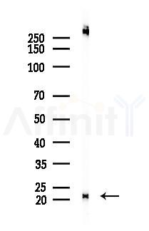 Caveolin 2 Recombinant Rabbit mAb - Western blot analysis of lysates from HUVEC cells(starvation 24h treatment), using Caveolin 2 Recombinant Rabbit mAb at 1/1000 dilution.