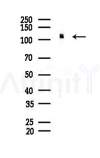 UAB1 Recombinant Rabbit mAb - Western blot analysis of lysates from Rat brain, using UAB1 Recombinant Rabbit mAb at 1/1000 dilution.