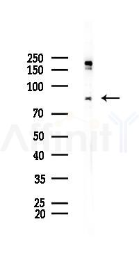 PROX1 Recombinant Rabbit mAb - Western blot analysis of lysates from PC12 cells(UV 30min treatment), using PROX1 Recombinant Rabbit mAb at 1/1000 dilution.