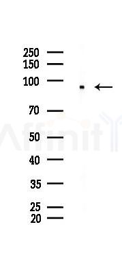 Mitofilin Recombinant Rabbit mAb - Western blot analysis of lysates from HUVEC cells(starvation 24h treatment), using Mitofilin Recombinant Rabbit mAb at 1/1000 dilution.