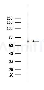 Catalase Recombinant Rabbit mAb - Western blot analysis of lysates from Rat lung, using Catalase Recombinant Rabbit mAb at 1/1000 dilution.
