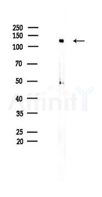 MCM2 Recombinant Rabbit mAb - Western blot analysis of lysates from K562 cells(heat-shock 45min treatment), using MCM2 Recombinant Rabbit mAb at 1/1000 dilution.