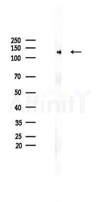 MCM2 Recombinant Rabbit mAb - Western blot analysis of lysates from B16F10-LUC cells(LPS 4h treatment), using MCM2 Recombinant Rabbit mAb at 1/1000 dilution.