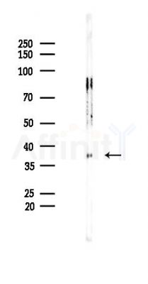 EpCAM Recombinant Rabbit mAb - Western blot analysis of lysates from Rat kidney, using EpCAM Recombinant Rabbit mAb at 1/1000 dilution.