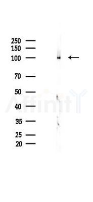 Rad21 Recombinant Rabbit mAb - Western blot analysis of lysates from B16F10-LUC cells(LPS 4h treatment), using Rad21 Recombinant Rabbit mAb at 1/1000 dilution.