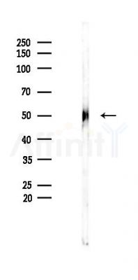 MEF2C Recombinant Rabbit mAb - Western blot analysis of lysates from K562 cells(heat-shock 45min treatment), using MEF2C Recombinant Rabbit mAb at 1/1000 dilution.