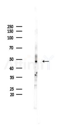 MEF2C Recombinant Rabbit mAb - Western blot analysis of lysates from Mouse brain, using MEF2C Recombinant Rabbit mAb at 1/1000 dilution.