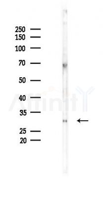 Caspase-14 Recombinant Rabbit mAb - Western blot analysis of lysates from K562 cells(heat-shock 45min treatment), using Caspase-14 Recombinant Rabbit mAb at 1/1000 dilution.