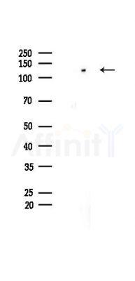 CDH10 Recombinant Rabbit mAb - Western blot analysis of lysates from Mouse brain, using CDH10 Recombinant Rabbit mAb at 1/1000 dilution.