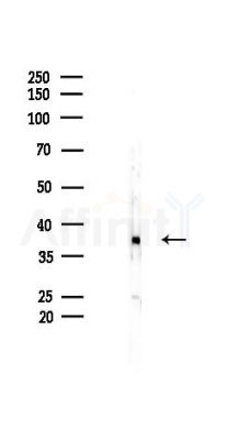 ATF1 Recombinant Rabbit mAb - Western blot analysis of lysates from K562 cells(heat-shock 45min treatment), using ATF1 Recombinant Rabbit mAb at 1/1000 dilution.