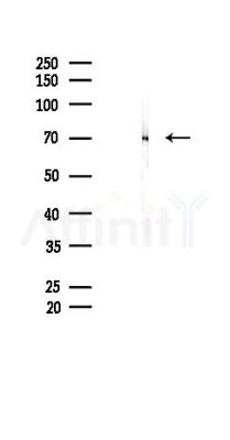 CBX4 Recombinant Rabbit mAb - Western blot analysis of lysates from K562 cells(heat-shock 45min treatment), using CBX4 Recombinant Rabbit mAb at 1/1000 dilution.
