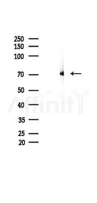 CBX4 Recombinant Rabbit mAb - Western blot analysis of lysates from B16F10-LUC cells(LPS 4h treatment), using CBX4 Recombinant Rabbit mAb at 1/1000 dilution.