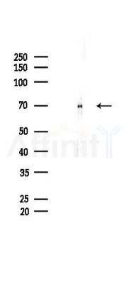 CBX4 Recombinant Rabbit mAb - Western blot analysis of lysates from Mouse brain, using CBX4 Recombinant Rabbit mAb at 1/1000 dilution.