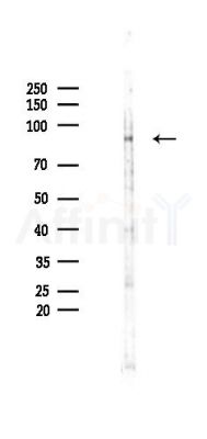 GRP94 Recombinant Rabbit mAb - Western blot analysis of lysates from B16F10-LUC cells(LPS 4h treatment), using GRP94 Recombinant Rabbit mAb at 1/1000 dilution.