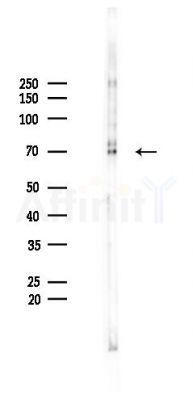 QSK Recombinant Rabbit mAb - Western blot analysis of lysates from Mouse brain, using QSK Recombinant Rabbit mAb at 1/1000 dilution.