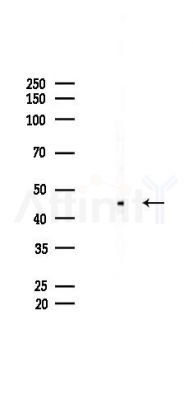 PAX8 Recombinant Rabbit mAb - Western blot analysis of lysates from Mouse brain, using PAX8 Recombinant Rabbit mAb at 1/1000 dilution.