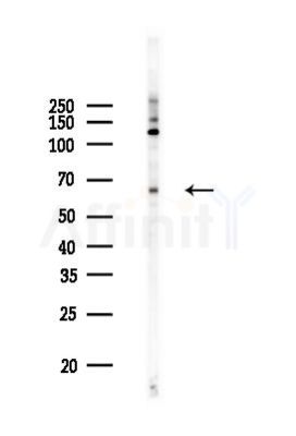 RelB Recombinant Rabbit mAb - Western blot analysis of lysates from 293 cells(heat-shock 45min treatment), using RelB Recombinant Rabbit mAb at 1/1000 dilution.