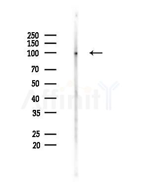 MVP Recombinant Rabbit mAb - Western blot analysis of lysates from K562 cells(heat-shock 45min treatment), using MVP Recombinant Rabbit mAb at 1/1000 dilution.