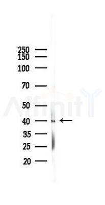 ERK1/2 Mouse monoclonal Antibody - Western blot analysis of lysates from Mouse heart, using ERK1/2 Mouse monoclonal Antibody at 1/1000 dilution.