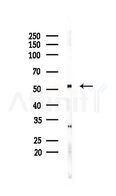 Vimentin mouse monoclonal Antibody - Western blot analysis of lysates from B16F10-LUC cells(UV 30min treatment), using Vimentin mouse monoclonal Antibody at 1/1000 dilution.