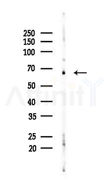 Lamin B1 Mouse Monoclonal Antibody - Western blot analysis of lysates from B16F10-LUC cells(UV 30min treatment), using Lamin B1 Mouse Monoclonal Antibody at 1/1000 dilution.