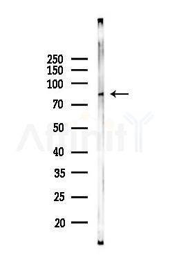 beta Catenin Monoclonal Antibody - Western blot analysis of lysates from Rat liver, using beta Catenin Monoclonal Antibody at 1/1000 dilution.