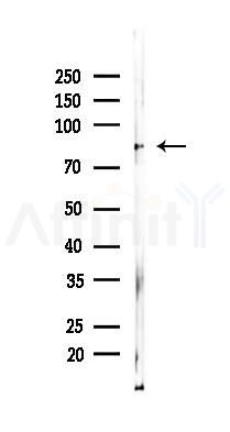 beta Catenin Monoclonal Antibody - Western blot analysis of lysates from Rat lung, using beta Catenin Monoclonal Antibody at 1/1000 dilution.
