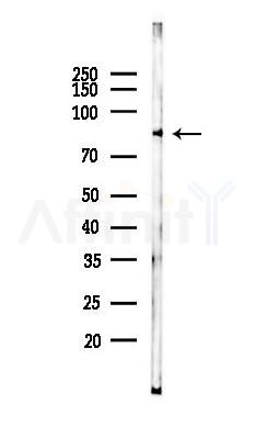 beta Catenin Monoclonal Antibody - Western blot analysis of lysates from PC12 cells(starvation 24h treatment), using beta Catenin Monoclonal Antibody at 1/1000 dilution.