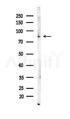 beta Catenin Monoclonal Antibody - Western blot analysis of lysates from HUVEC cells(UV 30min treatment), using beta Catenin Monoclonal Antibody at 1/1000 dilution.