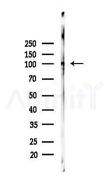 Nrf2 mouse monoclonal Antibody - Western blot analysis of lysates from Mouse lung, using Nrf2 mouse monoclonal Antibody at 1/1000 dilution.