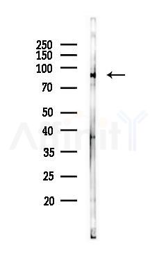 NLRP3 Mouse monoclonal Antibody - Western blot analysis of lysates from COLO205 cells(starvation 24h treatment), using NLRP3 Mouse monoclonal Antibody at 1/1000 dilution.