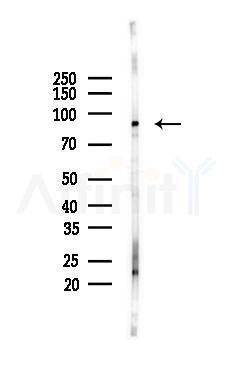 NLRP3 Mouse monoclonal Antibody - Western blot analysis of lysates from K562 cells(LPS 4h treatment), using NLRP3 Mouse monoclonal Antibody at 1/1000 dilution.