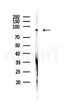 NLRP3 Mouse monoclonal Antibody - Western blot analysis of lysates from B16F10-LUC cells(heat-shock 45min treatment), using NLRP3 Mouse monoclonal Antibody at 1/1000 dilution.