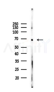 Estrogen Receptor-alpha Mouse monoclonal Antibody - Western blot analysis of lysates from RAW264.